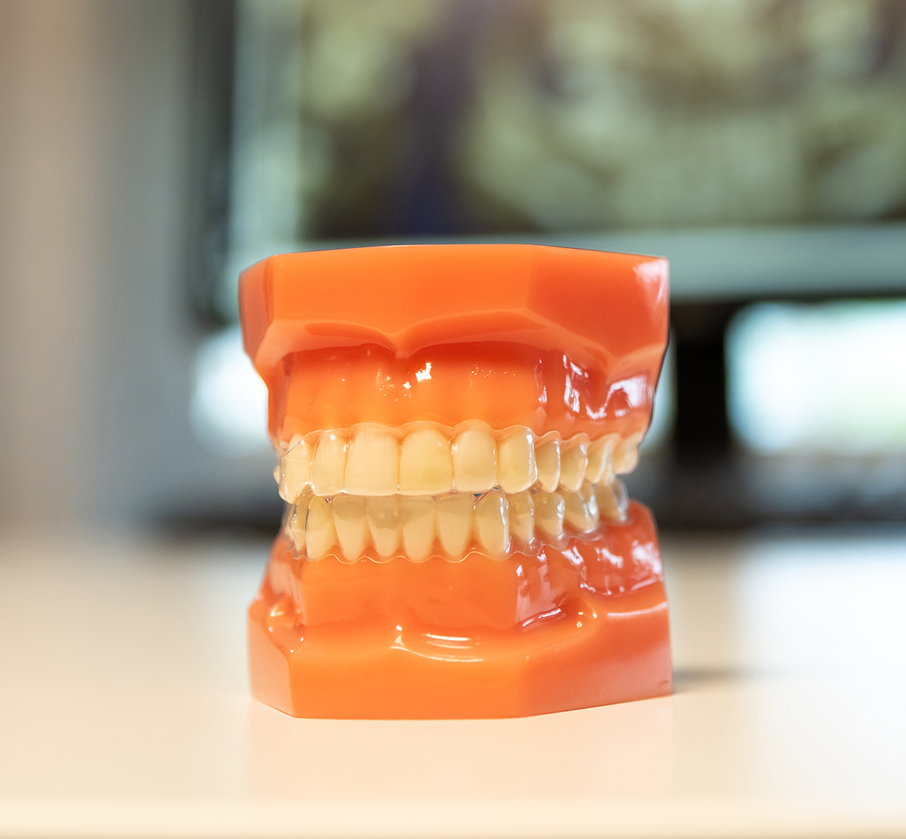 Botox for Bruxism Relieve Jaw Pain and Tooth Grinding Pinnacle Dental